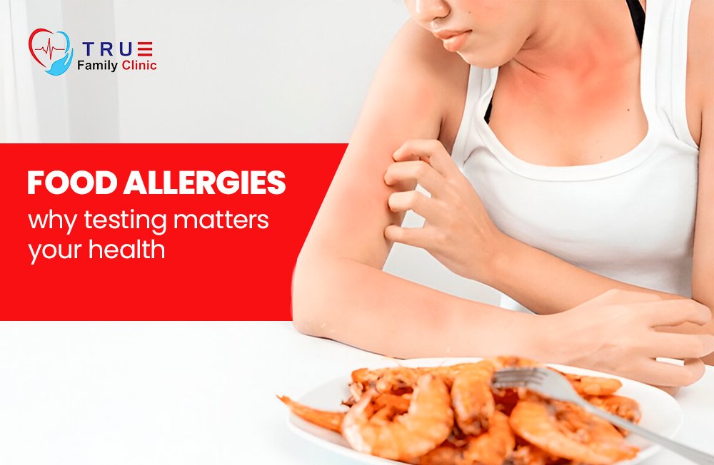 A person wearing a white tank top is scratching their arm, showing red irritated skin, possibly from a food allergy. In front of them is a plate of shrimp. On the left side, there is a red banner with white text that reads ‘FOOD ALLERGIES – why testing matters your health,’ and the logo of TRUE Family Clinic featuring a heart and pulse design.